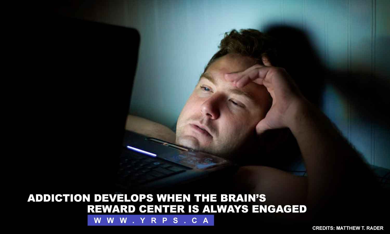 Addiction develops when the brain’s reward center is always engaged